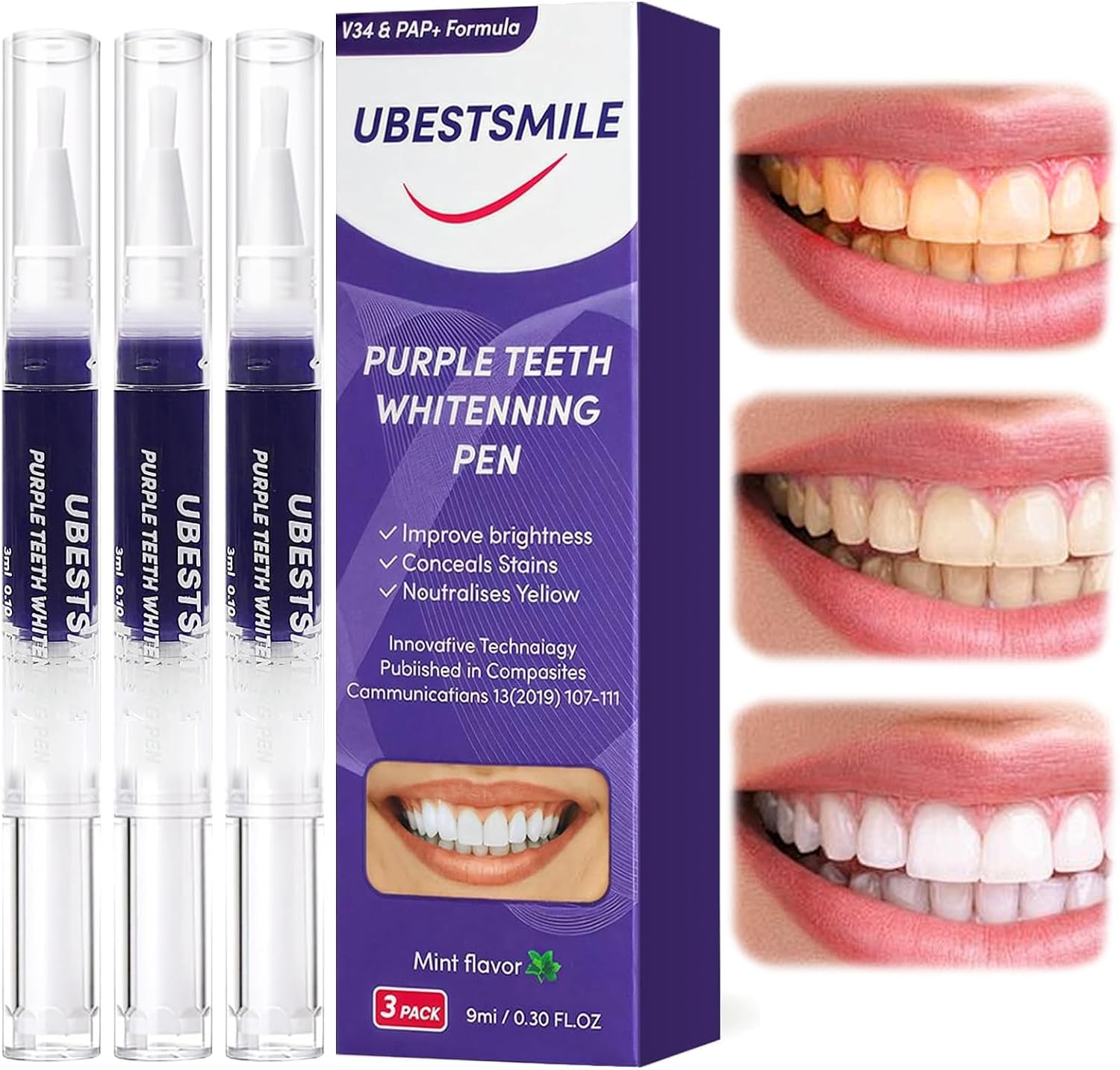 Teeth Whitening Pens - UBESTSMILE V34&PAP+ フォーミュラ パープル ホワイトニングペン ポータブル＆使いやすいデンタルケア