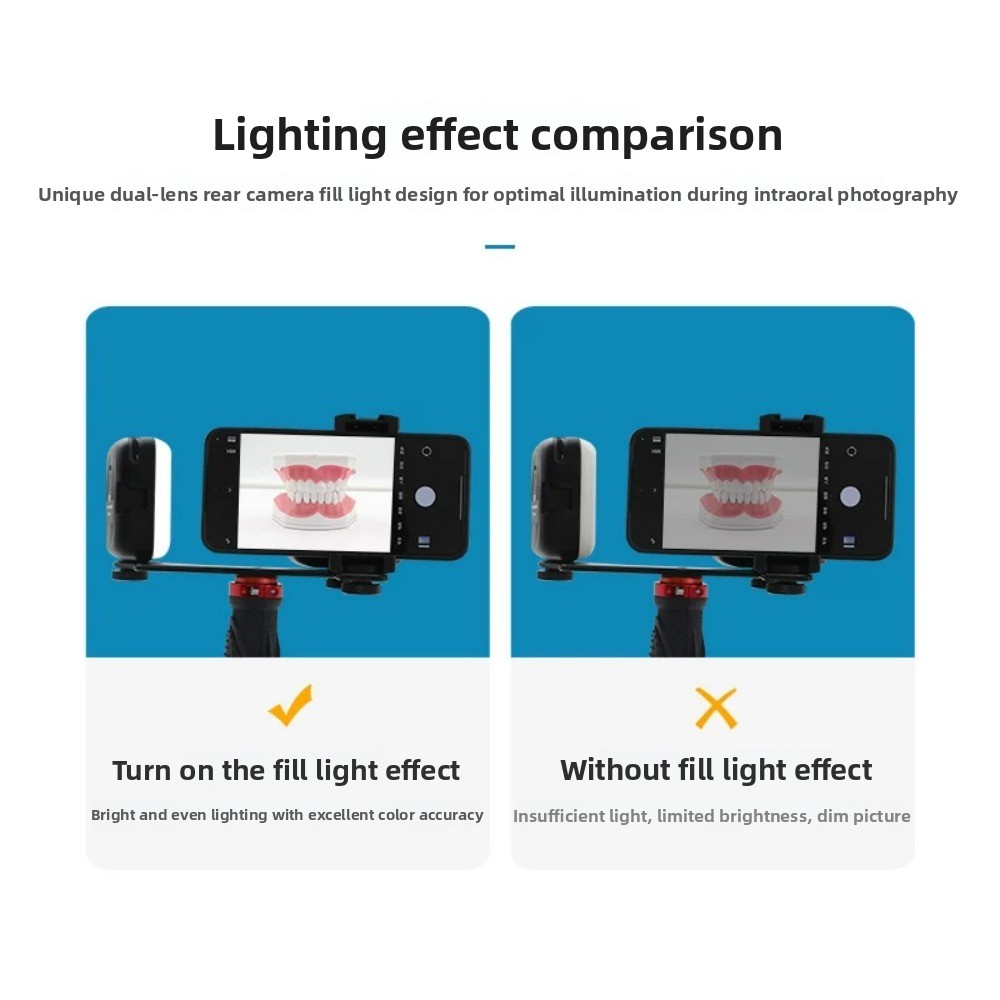 歯科用撮影ライト、スマートフォン用Bluetooth LED - Teeth Whitening Kit のレビューと価格