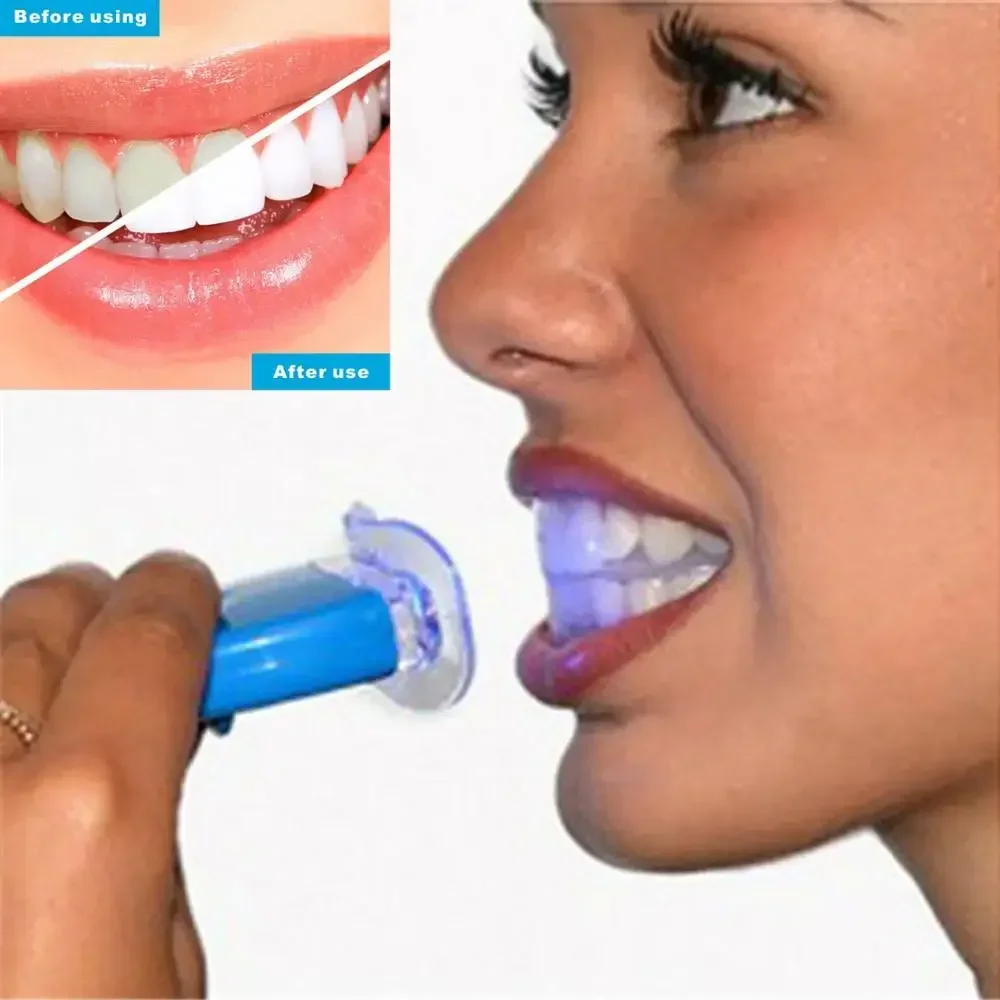 USB急速充電式ひげ＆ボディトリマー – コードレスメンズシ - Teeth Whitening Kit のレビューと価格