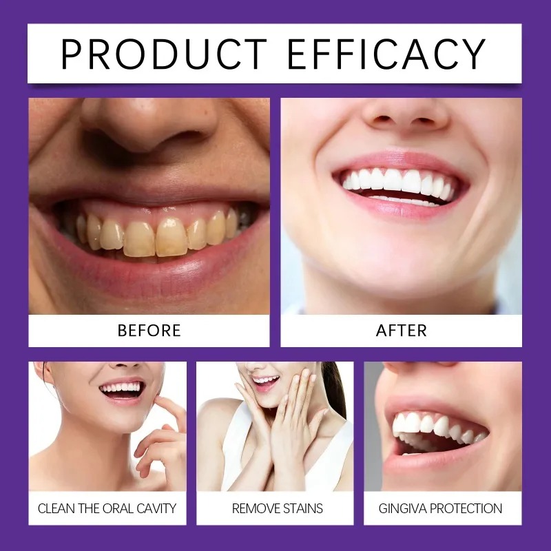 紫色の歯修復ミネラルパウダー、明るく白くするエナメル質に安全 - Teeth Whitening Near Me のレビューと価格