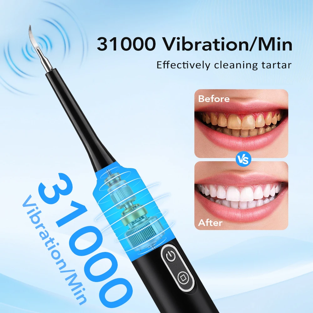 電気音波振動歯科用スケーラー歯のホワイトニング歯垢除去コーヒ - Teeth Whitening Mouthwash のレビューと価格