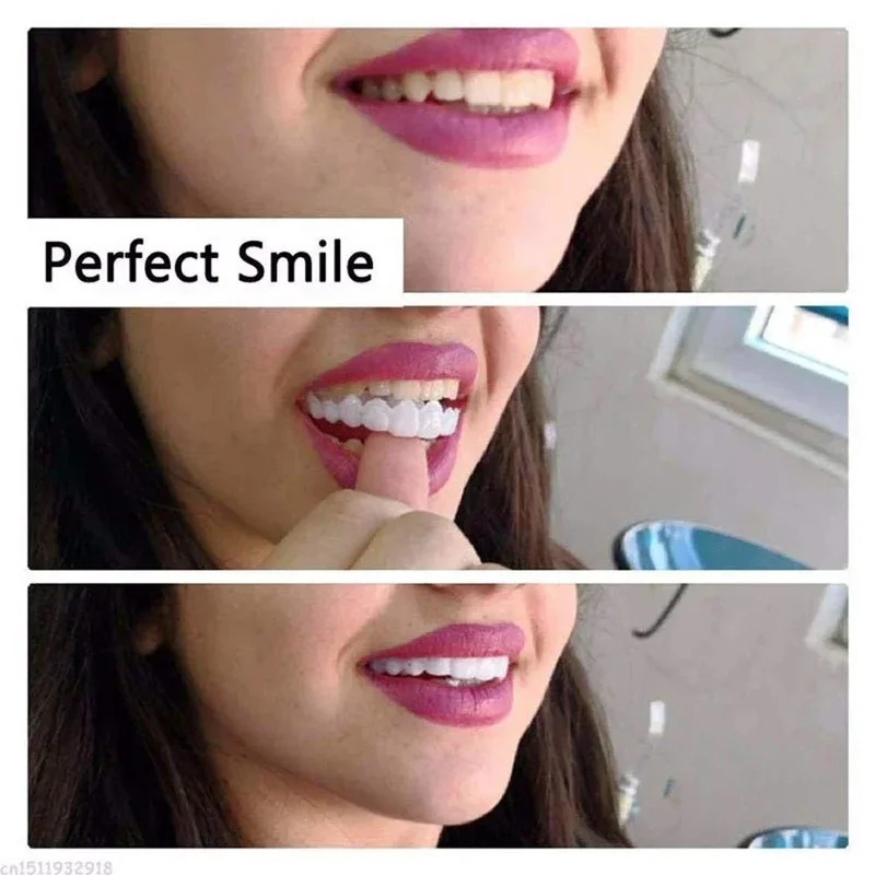 装着式のベニア歯キット。調整可能な美容用歯科ベニア。男性・女 - Teeth Whitening Kit のレビューと価格